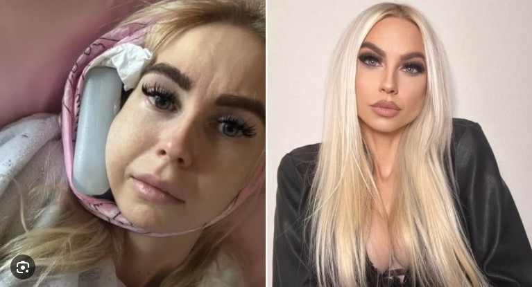 Žarnyno vėžiu serganti 29-erių Simona Milinytė pranešė liūdnas naujienas: „Pavargau nuo visų skausmų“ 1 simona