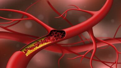 Patarimai, kaip sumažinti cholesterolį kraujyje be vaistų 4 kaip sumazinti cholesteroli kraujyje be vaistu