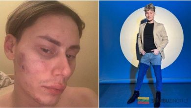 Ąžuolas Misiukevičius prakalbo apie santykiuose patirtą smurtą: „Pastarosios dienos man primena apie tai“ 7 azuolas