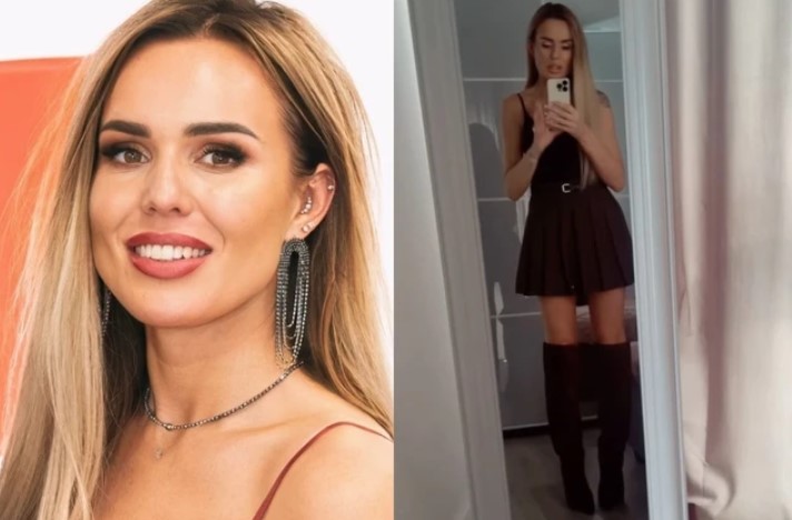 Laisva prabilo apie plastines operacijas: „Vyrą radau be krūtinės ir putlių lūpų“ 1 laisva